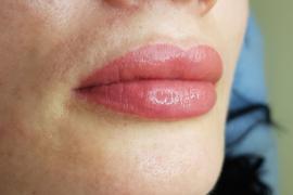 Губы, татуаж - фото сразу после процедуры комбинированной растушевки губ с мягким выделением контура